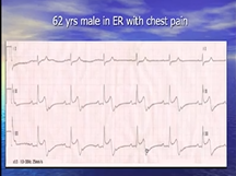 RS Academy Class Angiograms 23rd June 2020