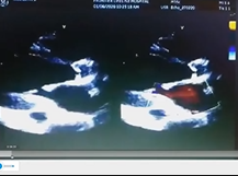 RS Academy Clinical Case Discussion Bluejeans