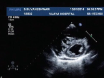 RS Academy ECHO CASES Bluejeans class 3rd June 2020 By Ramlal
