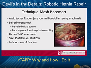 rTAPP: Why and How I Do It