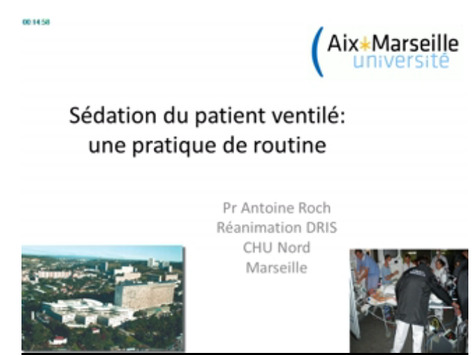 Sédation du malade ventilé - Une pratique de routine - 2015