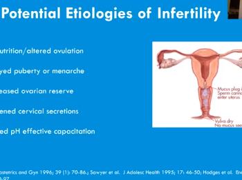 S08: Addressing Women's Health in Cystic Fibrosis S08: Addressing Women's Health in Cystic Fibrosis