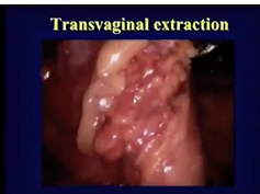 S086: Morris E Franklin, MD S086: Morris E Franklin, MD