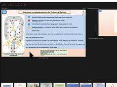 SAGES Colorectal Facebook Livestream: Different Approaches to Left Colectomy SAGES Colorectal Facebook Livestream: Different Approaches to Left Colectomy