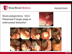 SAGES Flexible Endoscopy Livestream - Endoscopy Basics SAGES Flexible Endoscopy Livestream - Endoscopy Basics