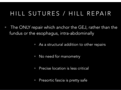 SAGES Foregut Facebook Livestream - Alternatives to Nissen SAGES Foregut Facebook Livestream - Alternatives to Nissen