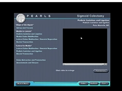 SAGES Pearls Session: Laparoscopic Sigmoid Colectomy - Technique Video-2 SAGES Pearls Session: Laparoscopic Sigmoid Colectomy - Technique Video-2