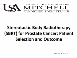 SBRT for Prostate cancer SBRT for Prostate cancer