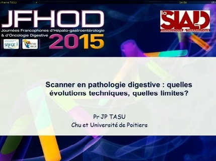Scanner en pathologie digestive : quelles évolutions techniques ces dernières années ? quelles limites ?