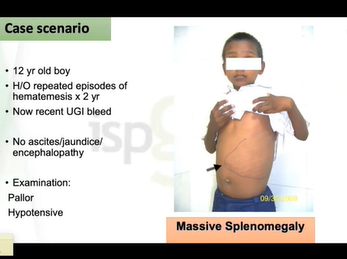 School going child with persisting jaundice - Case snippet -1 - ISPGHAN 2020 Conference School going child with persisting jaundice - Case snippet -1 - ISPGHAN 2020 Conference