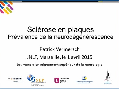 Sclerose en plaques : Prévalence de la neurodégénérescence