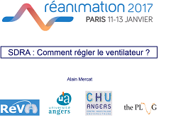 SDRA  Comment je règle le ventilateur ?