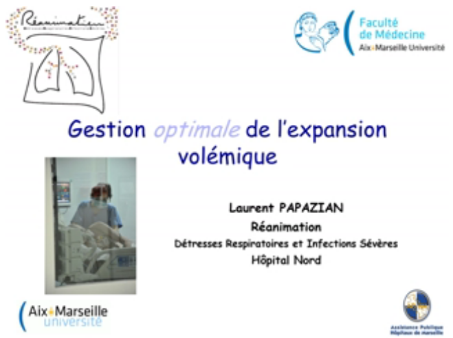 SDRA et circulation - Gestion optimale de l'expansion volémique - 2015
