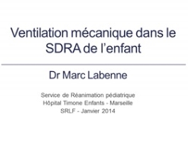 SDRA Pédiatrique - Ventilation mécanique du SDRA que doit savoir l'infirmière ? SDRA Pédiatrique - Ventilation mécanique du SDRA que doit savoir l'infirmière ?