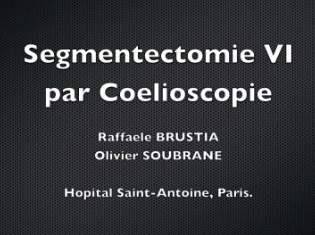 Segmentectomie VI par coelioscopie Segmentectomie VI par coelioscopie