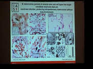 Session 2 - TB HIV 2019 Eduardo Gotuzzo y Rogelio Hdz Pando