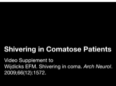Shivering in Comatose Patients Part 2 Shivering in Comatose Patients Part 2