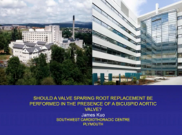 should a  valve sparing  root replacement be performed in the presence of a bicuspid aortic valve