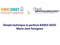 Simple Technique to Perform EASILY ACCC, Marie José Tassignon