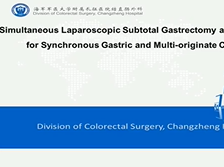 Simultaneous lap subtotal gastrectomy and total colectomy for synchronous gastric and colon cancers Simultaneous lap subtotal gastrectomy and total colectomy for synchronous gastric and colon cancers