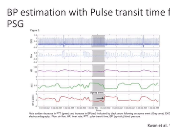 Sleep and Heart & Rhythm March