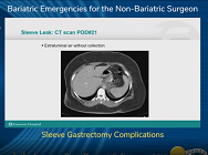 Sleeve Gastrectomy Complications