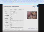 Sleeve gastrique en 2018 Sleeve gastrique en 2018