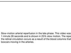Slow-Motion Arterial Reperfusion in the Late Phase at 1 Minute 26 Seconds Slow-Motion Arterial Reperfusion in the Late Phase at 1 Minute 26 Seconds