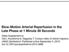 Slow-Motion Arterial Reperfusion in the Late Phase at 1 Minute 30 Seconds Slow-Motion Arterial Reperfusion in the Late Phase at 1 Minute 30 Seconds