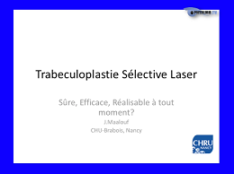 SLT : une technique sûre et efficace, réalisable à tout moment de l’évolution du glaucome
