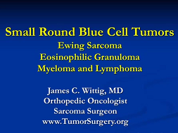 Small Round Blue Cell Tumors (Ewing Sarcoma, Lymphoma)