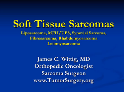 Soft Tissue Sarcomas