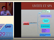 SPA et uvéites SPA et uvéites
