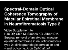 Spectral-Domain Optical Coherence Tomography of Macular Epiretinal Membrane in Neurofibromatosis Typ Spectral-Domain Optical Coherence Tomography of Macular Epiretinal Membrane in Neurofibromatosis Typ