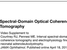 Spectral-Domain Optical Coherence Tomography Spectral-Domain Optical Coherence Tomography