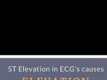 St elevation ECG/EKG interpretation DD