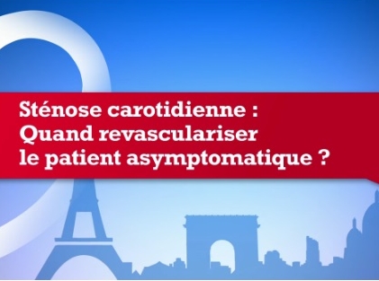 Sténose carotidienne quand revasculariser le patient asymptomatique?