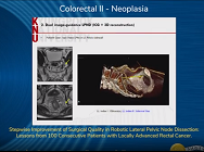 Stepwise Improvement of Surgical Quality in Robotic Lateral Pelvic Node Dissection Stepwise Improvement of Surgical Quality in Robotic Lateral Pelvic Node Dissection