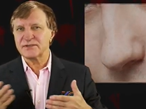 Straightening out Rhinoplasties. Plastic Surgery Hot Topics with Rod J. Rohrich, MD Straightening out Rhinoplasties. Plastic Surgery Hot Topics with Rod J. Rohrich, MD