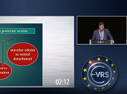 Subretinal Injections of BSS Combined with Vitrectomy