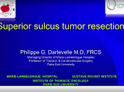 Superior sulcus tumour resection