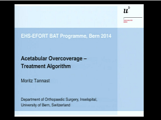 Sur-recouvrement acétabulaire - Algorithme de traitement