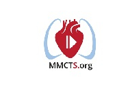 Surgery for ventricular tachycardia in patients undergoing surgical ventricular restoration Surgery for ventricular tachycardia in patients undergoing surgical ventricular restoration