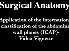 Surgical Anatomy Applied to the international classification of the abdominal wall planes (ICAP) Surgical Anatomy Applied to the international classification of the abdominal wall planes (ICAP)