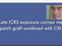 Surgical Management of Late Intracorneal Ring Segment Exposure, Cornea Melt and Perforation With an Annular Patch Graft Combined With Corneal Crosslinking Surgical Management of Late Intracorneal Ring Segment Exposure, Cornea Melt and Perforation With an Annular Patch Graft Combined With Corneal Crosslinking