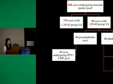 Surgical Outcomes of Macular Pucker Peel