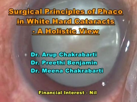 Surgical Principles of Phaco in White Hard Cataracts A Holistic View Surgical Principles of Phaco in White Hard Cataracts A Holistic View