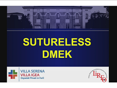 Sutureless Descemet Membrane Endothelial Keratoplasty Sutureless Descemet Membrane Endothelial Keratoplasty