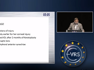 Sutureless Scleral Fixation of Dislocated Rayner Type C-flex