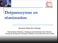 Syndrome thoracique aigu